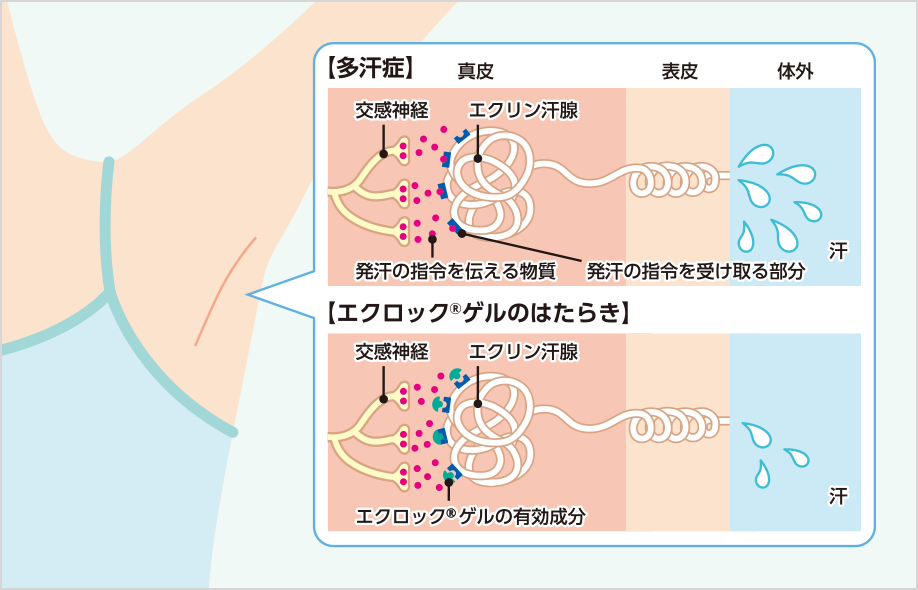 エクロックゲルの使い方 テキストと画像で見る エクロックinfo エクロックゲルを処方されている患者さんとご家族の方のための情報サイト 科研製薬株式会社